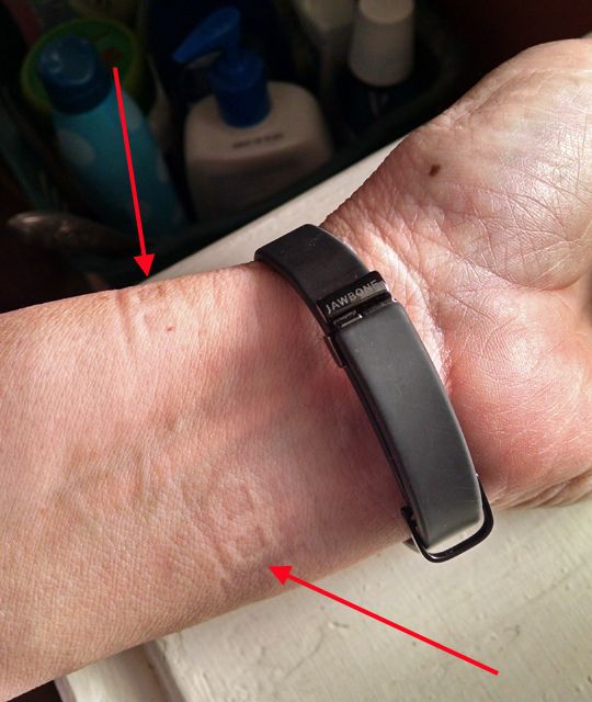 not my wrist with sensor imprints